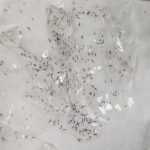 熊本｜医療脱毛からの乗り換えが増えています